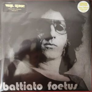 Foetus