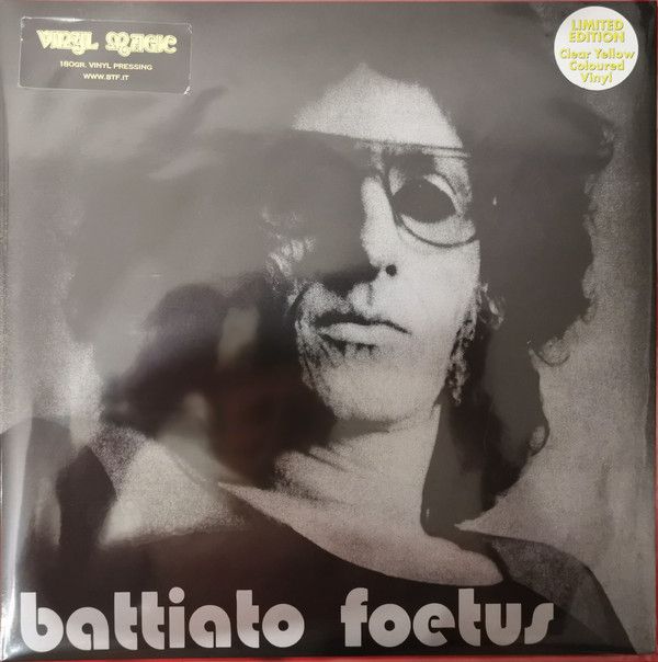 Foetus