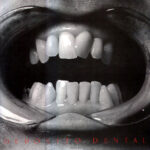 964924225d5ecaf5f3e040076482720e8421abb0_0_0.jpeg Depósito Dental